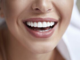 Frau mit weißen Zähnen.