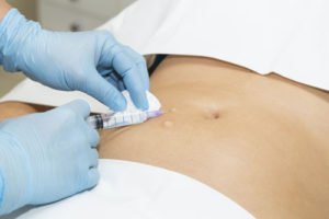 © lester120 - Fotolia.com Aqualyx ist die Weiterentwicklung der Fett-weg-Spritze