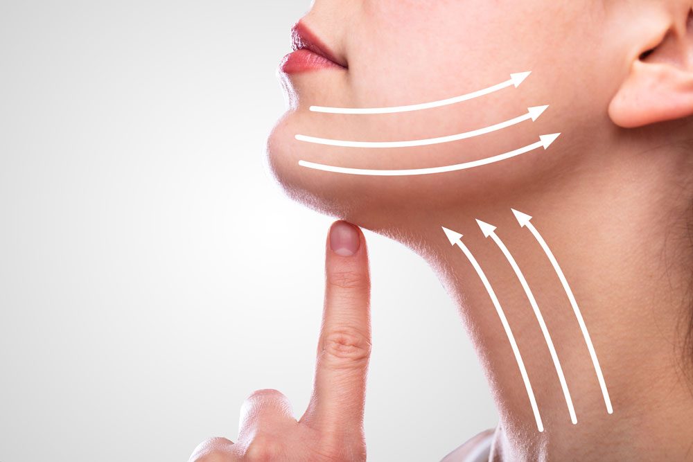 Facelifting Einzelne Gesichtspartien anheben -mit einem Facelifting möglich.
