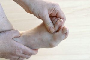 © Astrid Gast - Fotolia.com Hausmittel bei Nagelpilz