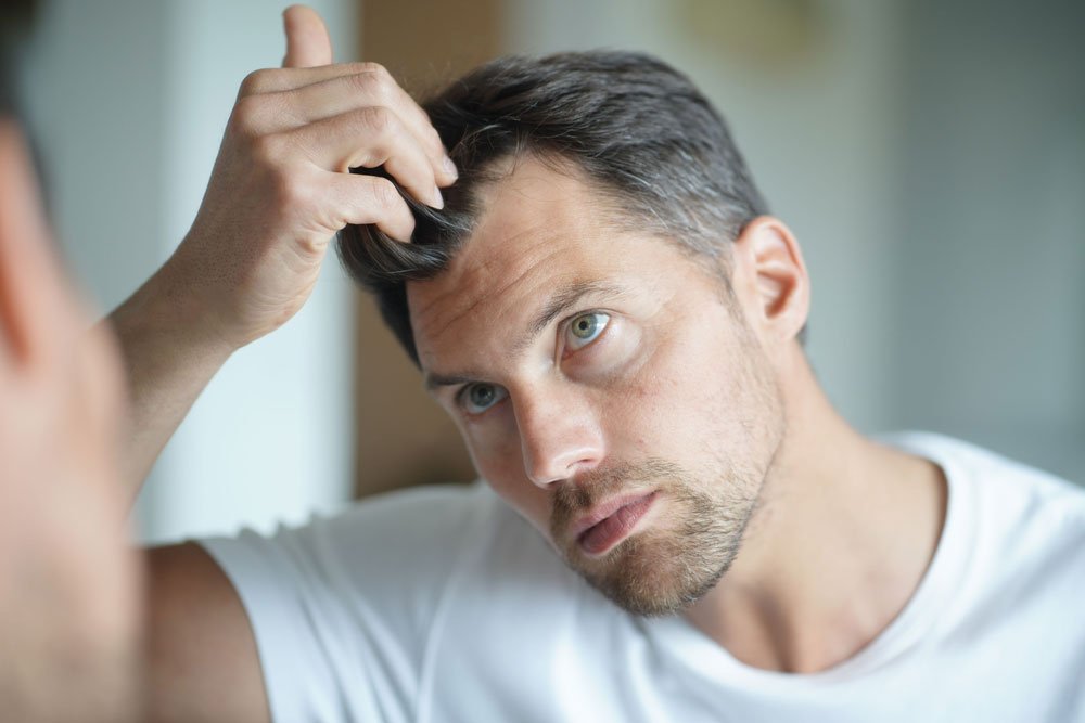 Geheimratsecken frisur mit für männer 43+ Frisuren