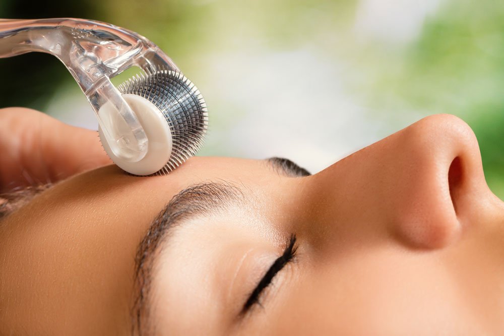 Wer den Dermaroller zuhause selber nutzt, kann viel Geld sparen Microneedling mit dem Dermaroller im Gesicht