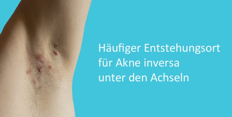 Pilz Unter Den Achseln Hausmittel