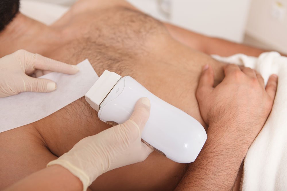 Waxing und Sugaring sind fast zwei identische Methoden Waxing einer Männerbrust